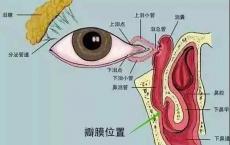 什么是泪道疾病？听听合肥爱尔眼科专家怎么说