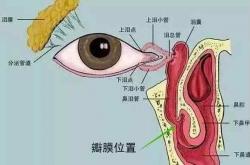 什么是泪道疾病？听听合肥爱尔眼科专家怎么说