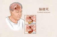 为何深夜容易突发脑梗?提醒中老年人:刚吃完晚饭,远离这3件事