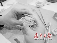 避免重度缺牙 远离慢性病